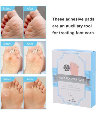 Artibetter 24Pcs Wart Remover Pads - Medicated Patches & Concealing Pads for Plantar Warts on Feet - Effective International Shipping - Buy Online on GoSupps.com