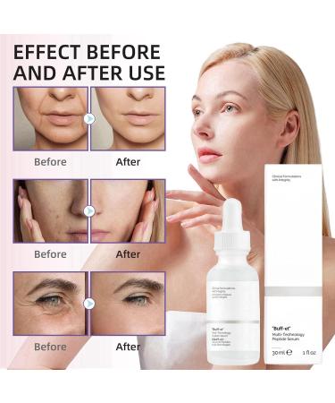 Buff-et Multi-Technology Peptide Serum Hydrating Face Serum for Women Anti-Aging Skincare Serum Firming Face Serum for Fine Lines&Wrinkles Facial Hyaluronic Acid Serum Hydrating Skincare for All Skin - Buy Online on GoSupps.com