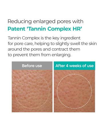 Buy BP Pore Clear Facial Mask 5EA - Deep Cleansing Hydrating International Shipping Available - Buy Online on GoSupps.com