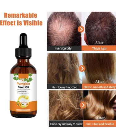 Pumpkin Seeds Oil Pumpkin Seed Oil For Hair Pumpkin Seed Oil Cold Pressed Skin Care Suitable For Men Women Pumpkin Seed Oil For Hair Face Nails Body Skin Pumpkin Seed Oil Pumpkin Oil - Buy Online on GoSupps.com