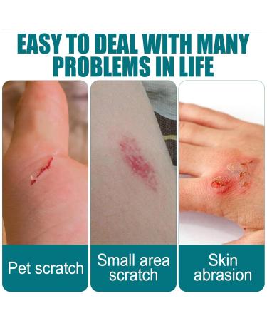 KOAHDE Gel Liquid Bandage 10ML - Breathable & Waterproof Wound Care for Minor Cuts - Buy Online on GoSupps.com
