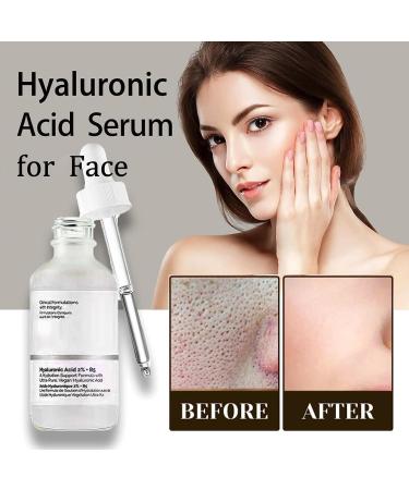 Hyaluronic Acid 2%+B5 Hyaluronic Acid Serum Acid Serum Anti Aging Facial Brightening Serum Hyaluronic Acid for Face Hydrated Hyaluronic Acid Serum for Hydrated Hydraulic Acid Serum - Buy Online on GoSupps.com