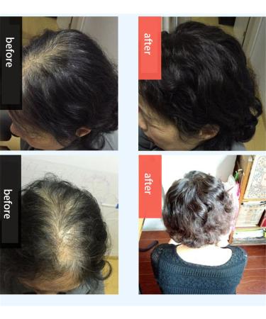 Wavy Clip-in Wiglet Hair Topper for Women with Thinning Hair - Real Dark Brown Hair Extensions - Buy Online on GoSupps.com