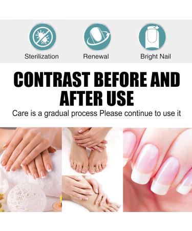 Keratin Nail Growth Oil Keratin 3 Day Growth Nail Treatment & Strengthener Nail Growth Treatment Nail Repair Treatment Nail Strengthener for Damaged Nails Strengthening Nail Polish - Buy Online on GoSupps.com