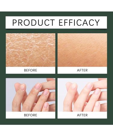 ZXSFDFNE Handmade Vanilla Rose Body Oil After Shower Body Moisturizing Oil Nourishing Hair and Body Oil Nourishing Nails Hair and Skin - Buy Online on GoSupps.com