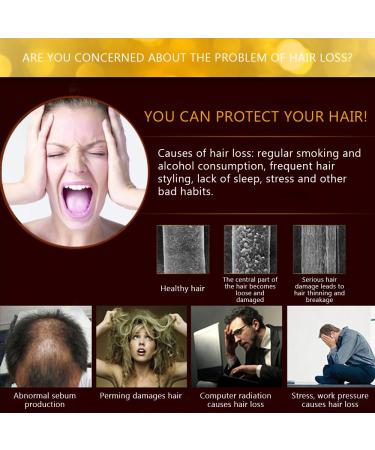 Andrea Hair Growth Essence - Stop Hair Loss Treatment with Ginger & Ginseng - 20ml - Buy Online on GoSupps.com