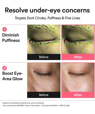 Abib Patchs Oculaires R tiniens Pdrn Glow Jelly Cor ens Pour Les Yeux Gonfl s Et Les Cernes Antirides Collag ne Caf ine Niacinamide 60 Patchs. - Buy Online on GoSupps.com