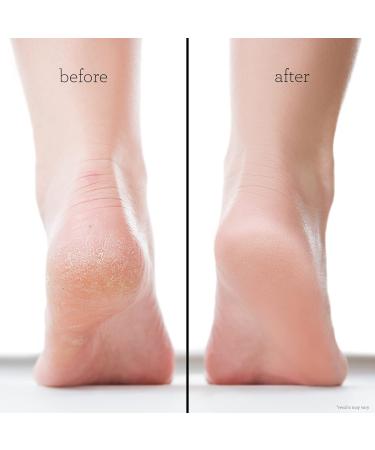 2 Pair Danielle Creations Moisturizing Foot Mask - Lavender - Buy Online on GoSupps.com