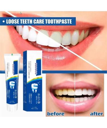 Consentbil Repair Probiotic Toothpaste Whitening Toothpaste Repairs and Protects Whitening Toothpaste Removes Tooth Stains Fresh Breath - Buy Online on GoSupps.com