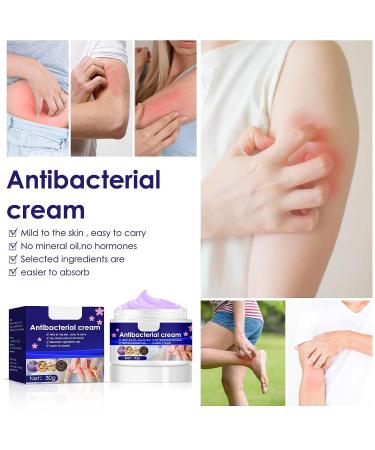 Gentle 30g Itch Relief Cream with Violets Cnidium Extract - Anti-Itch Ointment for Sensitive Dry Skin - Buy Online on GoSupps.com