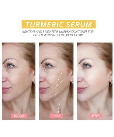 2023 New Turmeric Dark Spot Corrector Serum for Hyperpigmentation & Age Spots - Skin Care Moisturizing Repair Essence for Men & Women - Buy Online on GoSupps.com