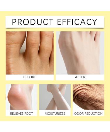  XUSHAOLUN Moisturizing cream with 60% urea and tea tree oil fast-absorbing and non-greasy for hands and feet. Long-lasting moisturizing care for rough and soothing skin. (4 pieces) - Buy Online on GoSupps.com