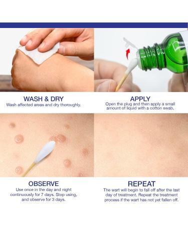 Dr. Luke Genital Wart Liquid - Fast-Acting Wart Treatment for Men & Women | 30 ml Exclusive Formula for Genital Common Filiform and Flat Warts - Buy Online on GoSupps.com