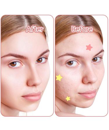 Buy Sibba Face Pimple Patches - 480 Pcs Colorful Hydrocolloid Zit Covers | Cute Star Spot Stickers for Effective Acne Treatment - Buy Online on GoSupps.com