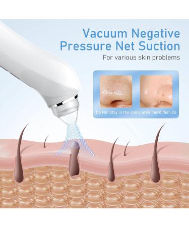 Blackhead Remover Vacuum Black Head Extractions Tool with Camerafor USB Interface Type Pore Vacuum Men and Women Pore Cleaner 6 Suction Heads & 3 Adjustment Modes - Buy Online on GoSupps.com