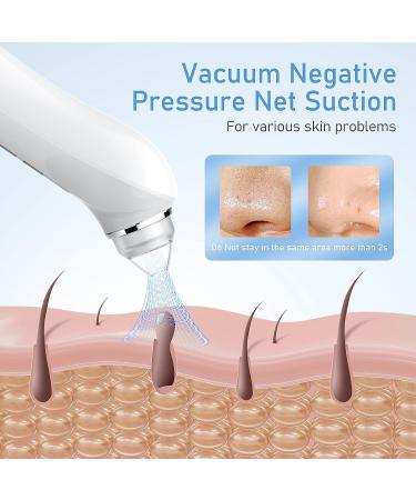Blackhead Remover Vacuum with Camera | USB Pore Vacuum for Men and Women | 6 Suction Heads & 3 Modes | Blue - Buy Online on GoSupps.com