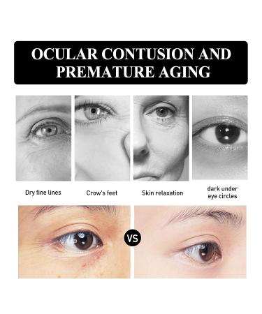 Verfons Snake Venom Firming Eye Cream - Anti Aging Treatment for Eye Bags, Fine Lines, and Wrinkles - 1 Fl Oz - Buy Online on GoSupps.com