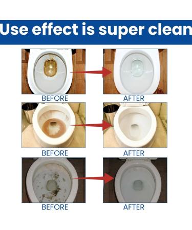 Toilet Bowl Cleaner Toilet Cleaning Tablets Toilet Limescale Remover Toilet Bleach Cleaner Active Tablets Toilet Descaler Heavy Duty Toilet Fresheners Fizzy Foam Toilet Cleaner Toilet Deodoriser Block - Buy Online on GoSupps.com