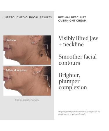 Murad Retinal Body & Night Cream Combo - ReSculpt Body Treatment & Overnight Cream for targeting Crepey Skin Cellulite Wrinkles and Stretch Marks Set of 2 - Buy Online on GoSupps.com