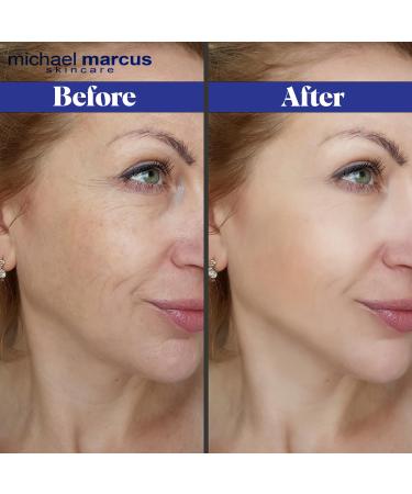 Micheal Marcus Hydromarine Eye Lift Serum - Reduce Wrinkles & Puffiness Brighten Dark Circles - 30ml Under Eye Serum for Improved Skin Elasticity & Texture - Buy Online on GoSupps.com