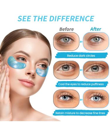 Under Eye Patches for Puffy Eyes - 24 Pairs Retinol Collagen Gel Pads Anti-Aging Eye Masks for Wrinkle Reduction & Moisturizing - Fast International Shipping - Buy Online on GoSupps.com