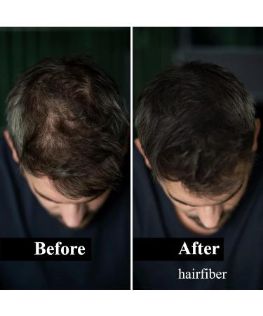 LEON MIGUEL Hair Fiber - Instant Hair Thickener for Receding Hairlines & Balding Areas - Dark Brown 25g - Buy Online on GoSupps.com