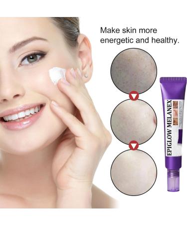 JIAOY EPIGLOW Advanced Pigmentation Cream Tone Correction Moisturizer EPIGLOW Pigmentation Treatment Cream AntiAging Face Removes Dark Spots Skin Buildup 6 Pack 6 Pack - Buy Online on GoSupps.com