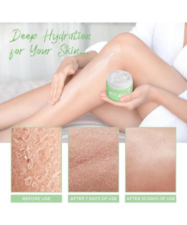 Urea Foot Cream Urea Cream 40 Percent for feet with Hyaluronic Acid Tea Tree and Aloe Vera for Deep Moisture Urea Cream for Feet Hands Heels Elbows Nails and Knees - Buy Online on GoSupps.com