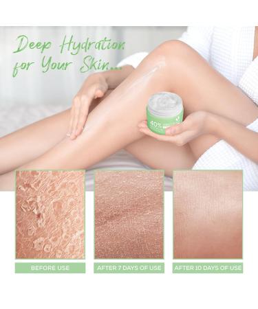 40% Urea Cream with 2% Salicylic Acid - Intensive Foot Cream for Dry Cracked Skin - Aloe Vera & Tea Tree - Exfoliates Dead Skin - 4.2 oz - Buy Online on GoSupps.com