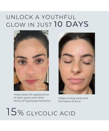 InstaSkincare Glycolic Acid Serum 15% - 8oz Extra Large for Radiant Skin Texture Improvement & Fine Lines - Best Serum for Uneven Tone - Buy Online on GoSupps.com