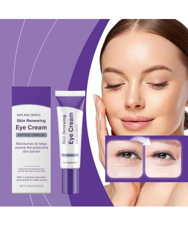 Eye Contour Cream Retinol Intense Reactivating Eye Cream Lovilds Skin Renewing Eye Cream For Wrinkles Care Action Eye Cream Fine Lines And Dark Rings For Gentle Eye Care To Fight Signs (1) - Buy Online on GoSupps.com