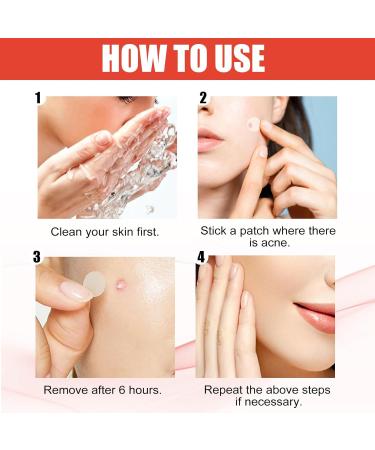 Original Hydrocolloid Acne Patches - 108 Count Spot Stickers for Zits & Blemishes | International Shipping - Buy Online on GoSupps.com