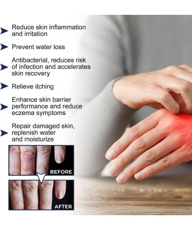 MUTYNE Eczema Therapy Spray: Natural Relief for Fast-Acting Itch Relief and Hydration - 2PCS - Buy Online on GoSupps.com