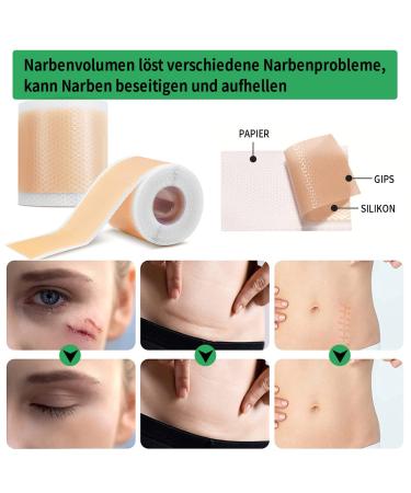 Silicone Scar Sheets - Professional Silicone Paving for Scars 4cm x 150cm Roll Ideal for C-section Burns Keloid & Acne - Medication-Free Solution - Buy Online on GoSupps.com