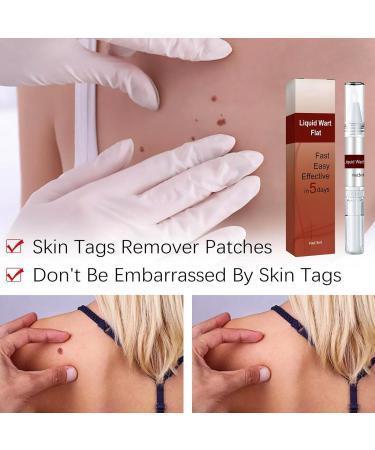 Skin Tags & Moles Remover - Fast & Effective Liquid Pen - 2PC Set - Buy Online on GoSupps.com