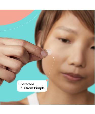 Skinchoice Breakout Pimple Plaster - 75 Hydrocolloid Acne Treatment Vegan & Cruelty-Free Powerful Pimple Relief (1 Pack) - Buy Online on GoSupps.com