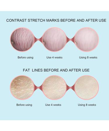 100g Polypeptide Body Repair Cream - Effective Stretch Mark & Scar Removal for Post-Pregnancy & Obesity Folds - Buy Online on GoSupps.com