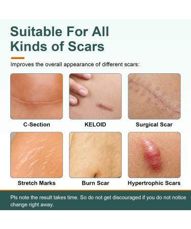 FUNNIR Silicone Scar Sheets 6 Pack - Healing C-Section and Tummy Tuck Keloid Scars - Surgical Cream Gel Patch Bandage - 5.7x1.57 - Buy Online on GoSupps.com