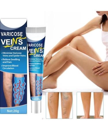 Varicose Vein Cream 20g - Pain Relief & Spider Veins Repair - Buy Online on GoSupps.com