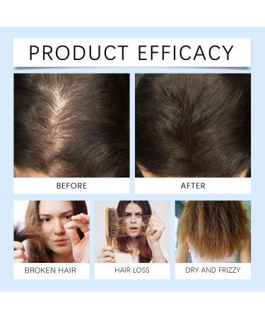  homomdy Rosemary Hair Growth Serum Roll Up Hair Growth Serum Roll-Up Care Serum to Prevent Hair Loss Strengthen and Encourage Thicker Hair for Men and Women Enhances Hair - Buy Online on GoSupps.com
