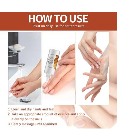 Cuticle Remover Cream Nail Cuticle Remover Gel Cuticle Oil for Nails Cuticle Care Gel Cuticle Remover Liquid Nail Treatments Cuticle Softener and Remover Nail Oil Cuticle Pen Instant Cuticle Remover - Buy Online on GoSupps.com