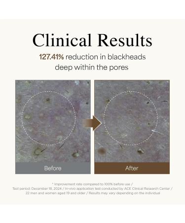 9 wishes Rice Foaming Cleanser - Pore Cleanser with Real Rice Powder for Gentle Exfoliation and Blackhead Removal, Korean Skin Care, 4 fl oz 120 ml - Buy Online on GoSupps.com