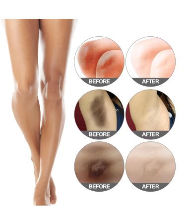 G neric 1/2/3/5pcs 30ml Crema Para Manchas Oscuras En La Cara 2026 New Crema Para Las Manchas De La Cara Para Piel Entrepierna Manchas Codos Piernas Zonas Rodillas Cuello (5pcs) - Buy Online on GoSupps.com