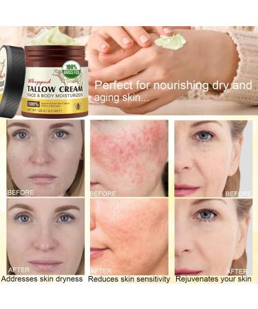 Beef Tallow Skincare Lot de 2 cr mes bio pour le visage et le corps 100 % herbe Fed Beef Tallow hydratation profonde et soin du suif de b uf cr me biologique absorption rapide pour peaux sensibles - Buy Online on GoSupps.com