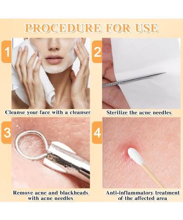 JIEYAO 4-Piece Tweezers Set for Removing Blackheads Pimple Ejector Tool Set Blackhead Extractor Tweezers for Whiteheads Blemishes Comedones Make-Up Tool Made of Stainless Steel - Buy Online on GoSupps.com