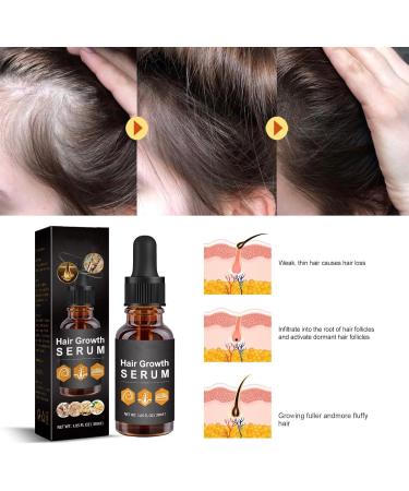 Hair Growth Serum for Black Women Hair Growth Oil New Hair Growth Serum Anti Hair Loss Nourishes Dry and Damaged Hair - Buy Online on GoSupps.com
