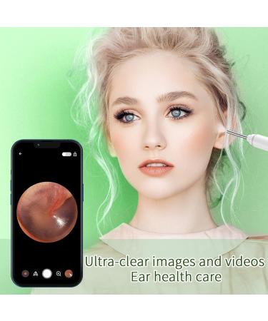 VITCOCO Wireless Ear Wax Removal Kit 1920P Camera with 6 LED Lights for iPhone Android iPad - White - Buy Online on GoSupps.com