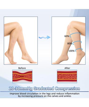 Bella Medical Compression Stockings for Women | 23-32 mmHg Varicose Veins Edema Circulation Support | Beige - Buy Online on GoSupps.com