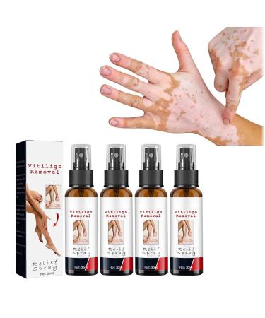 DUBUSH Vitiligo Kalmerende Spray Vitiligo Skin Repair Spray