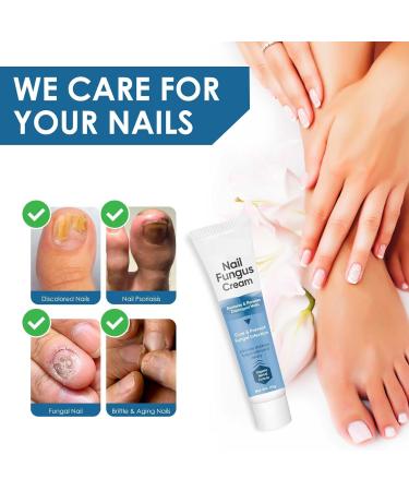 Nail Repair Cream: Maximum Strength Fungal Treatment for Toenails - Restores Healthy Appearance - Buy Online on GoSupps.com